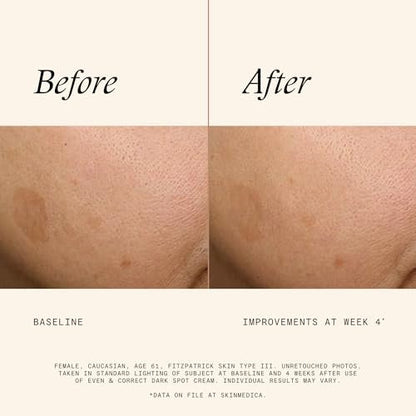 SkinMedica Even & Correct Dark Spot Cream - 0.5 Fl Oz | Reduce Stubborn Dark Spots Avelisse