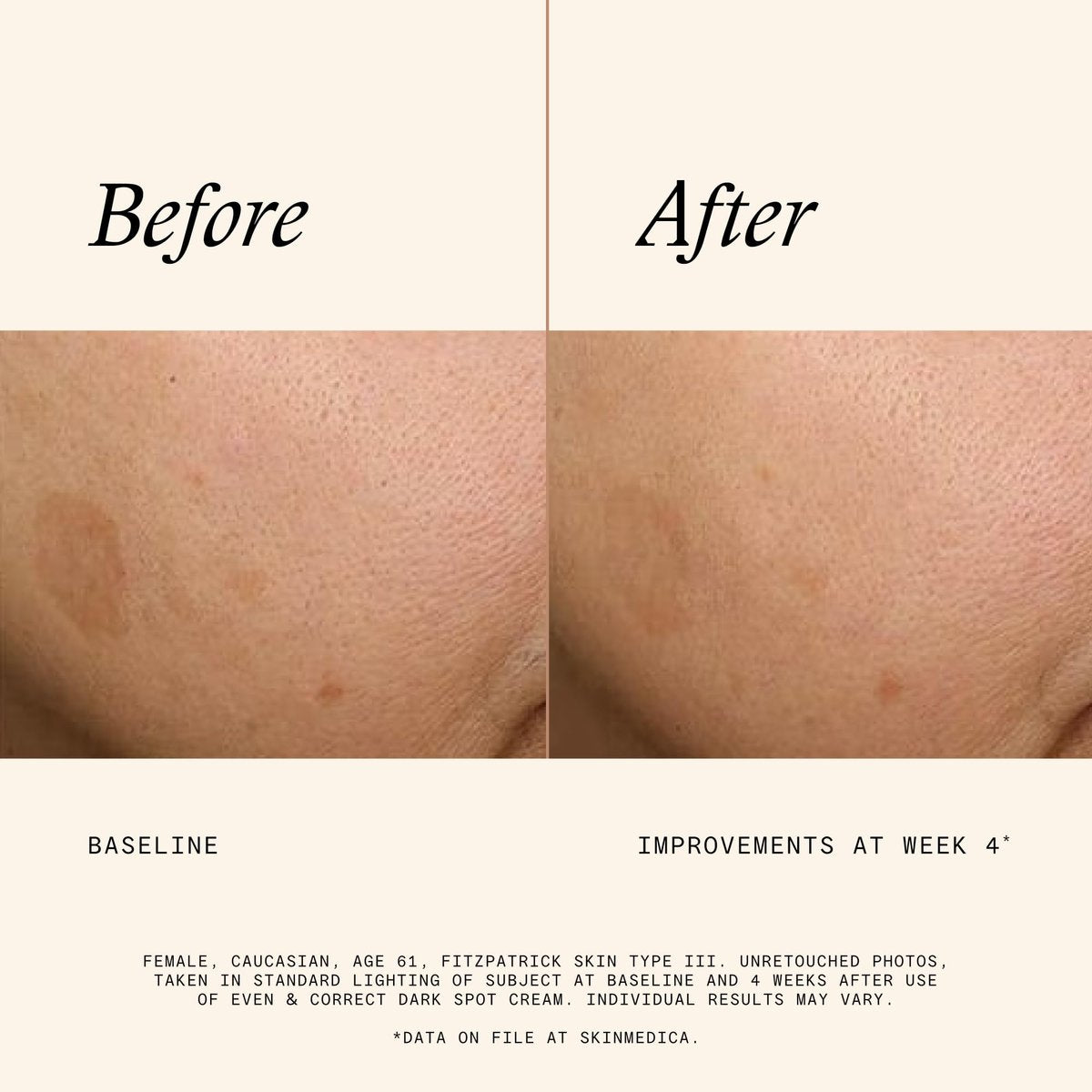 SkinMedica Even & Correct Dark Spot Cream - 0.5 Fl Oz | Reduce Stubborn Dark Spots Avelisse