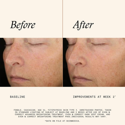 SkinMedica Even & Correct Brightening Treatment Pads – 10% Glycolic Acid Exfoliating Face Pads, Retinol-Free, Alcohol-Free, Hydroquinone-Free, 60 Count Avelisse