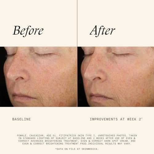 SkinMedica Even & Correct Brightening Treatment Pads – 10% Glycolic Acid Exfoliating Face Pads, Retinol-Free, Alcohol-Free, Hydroquinone-Free, 60 Count Avelisse
