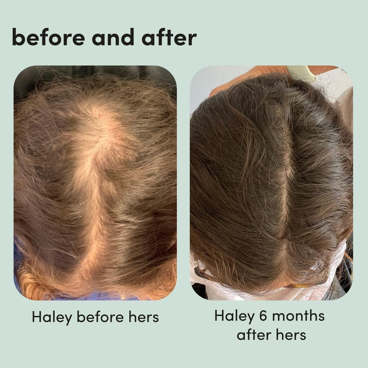 Hers Triple Threat Shampoo, Conditioner, & Minoxidil Set - Hair Thickening & Strengthening with 5% Minoxidil Foam - Paraben-Free, Vegan, Color-Safe - 3 Count Avelisse
