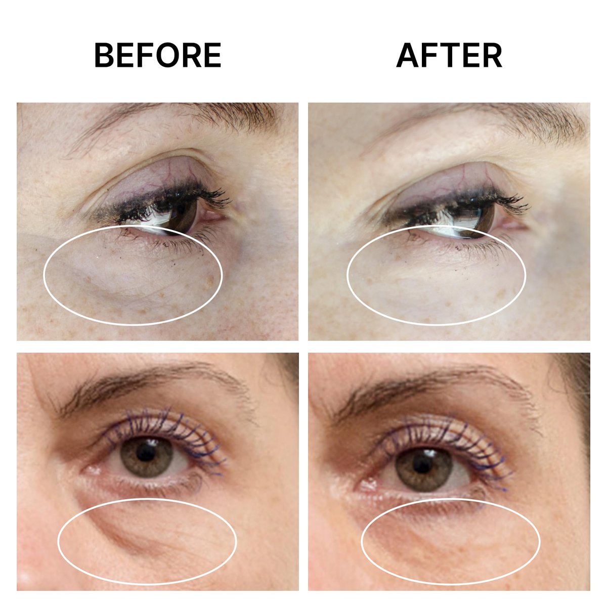 SEAMANTIKA PUFFINESS AWAY Eye Cream - Instant Eye Bag Remover with Eyeliss & Vitamin C, 0.8 fl oz - Temporary Reduction of Puffiness, Wrinkles & Dark Circles Avelisse