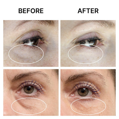 SEAMANTIKA PUFFINESS AWAY Eye Cream - Instant Eye Bag Remover with Eyeliss & Vitamin C, 0.8 fl oz - Temporary Reduction of Puffiness, Wrinkles & Dark Circles Avelisse