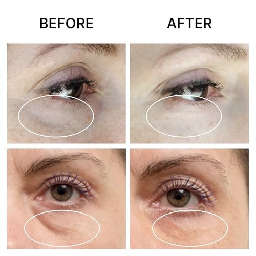 SEAMANTIKA PUFFINESS AWAY Eye Cream - Instant Eye Bag Remover with Eyeliss & Vitamin C, 0.8 fl oz - Temporary Reduction of Puffiness, Wrinkles & Dark Circles Avelisse