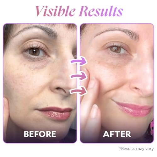 FIÈRA Bakuchiol Firming Eye Cream - Anti-Aging, Hydrating & Rejuvenating for Mature Skin - 15 ML Avelisse