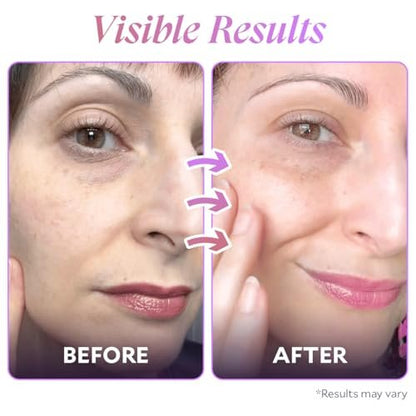 FIÈRA Bakuchiol Firming Eye Cream - Anti-Aging, Hydrating & Rejuvenating for Mature Skin - 15 ML Avelisse
