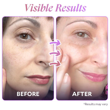 FIÈRA Bakuchiol Firming Eye Cream - Anti-Aging, Hydrating & Rejuvenating for Mature Skin - 15 ML Avelisse