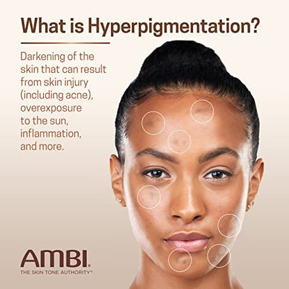 Ambi Even & Clear Advanced Fade Cream – Hydroquinone-Free Dark Spot Corrector with Niacinamide & Licorice Root, 1 Fl Oz