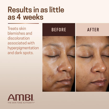 Ambi Even & Clear Advanced Fade Cream – Hydroquinone-Free Dark Spot Corrector with Niacinamide & Licorice Root, 1 Fl Oz