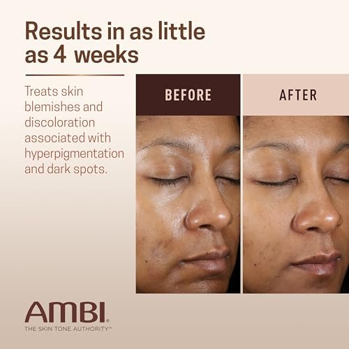 Ambi Even & Clear Advanced Fade Cream – Hydroquinone-Free Dark Spot Corrector with Niacinamide & Licorice Root, 1 Fl Oz - görsel 7