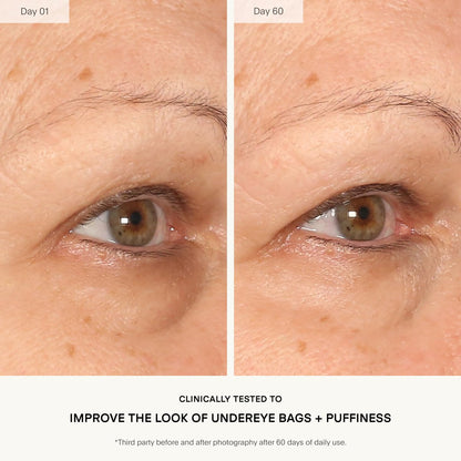 U Beauty The RETURN Eye Concentrate – Anti-Aging Eye Cream with Peptides & Antioxidants for Brighter, Tighter Under Eyes – Reduce Fine Lines, Puffiness & Dark Circles (0.5 fl oz) Avelisse