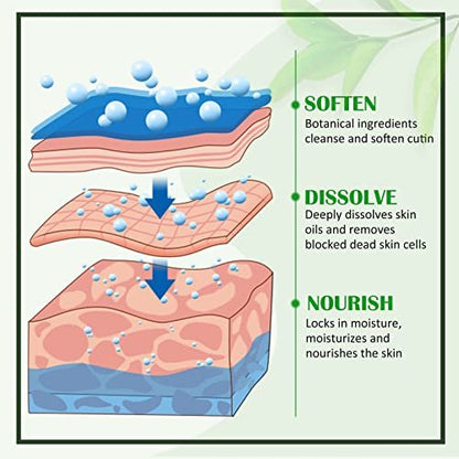 Green Tea Hydrating Foot Peel Spray - Instantly Remove Dead Skin, 3.38 Fl Oz
