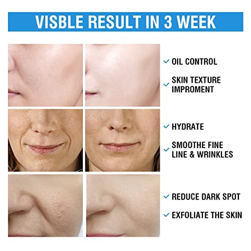 BACHERI 10% Glycolic Acid + 2% Salicylic Acid Peel Pads - Resurfacing Exfoliating Facial Pads with Vitamins B5, C, E & Allantoin for Dark Spots, Blackheads, Acne - 55 Count - görsel 12