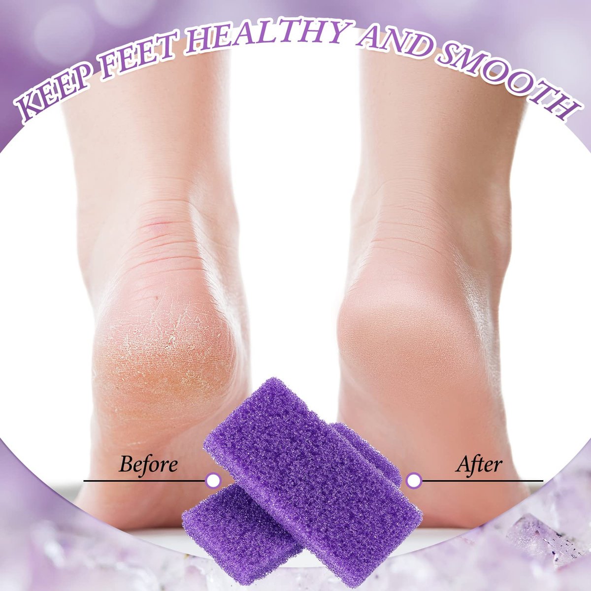 Dunzy 200 Pcs Disposable Pumice Stones for Feet - Professional Pedicure Callus Remover Blocks for Spa Salon Pedicure Supplies, Foot Exfoliating Scrubber for Dead Skin and Heel Care Avelisse