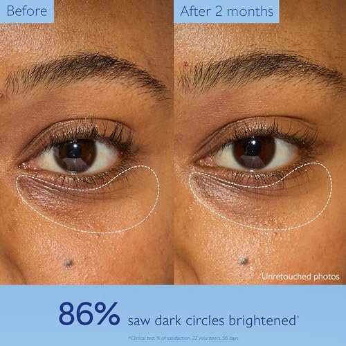 Caudalie Vinoperfect Dark Circle Brightening Caffeine Eye Cream with Niacinamide, Fragrance Free - 15 mL Avelisse