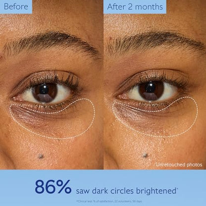 Caudalie Vinoperfect Dark Circle Brightening Caffeine Eye Cream with Niacinamide, Fragrance Free - 15 mL Avelisse