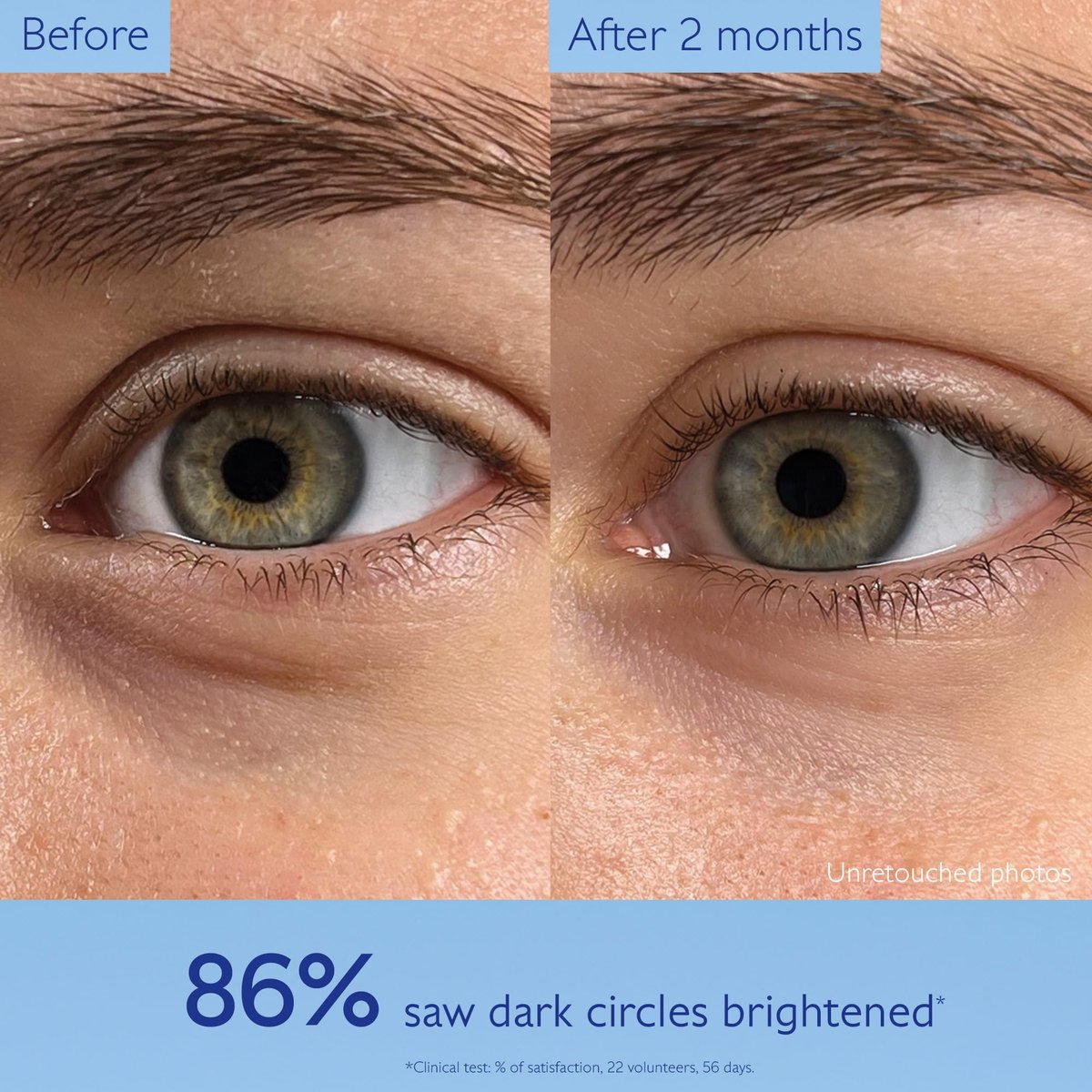 Caudalie Vinoperfect Dark Circle Brightening Caffeine Eye Cream with Niacinamide, Fragrance Free - 15 mL Avelisse