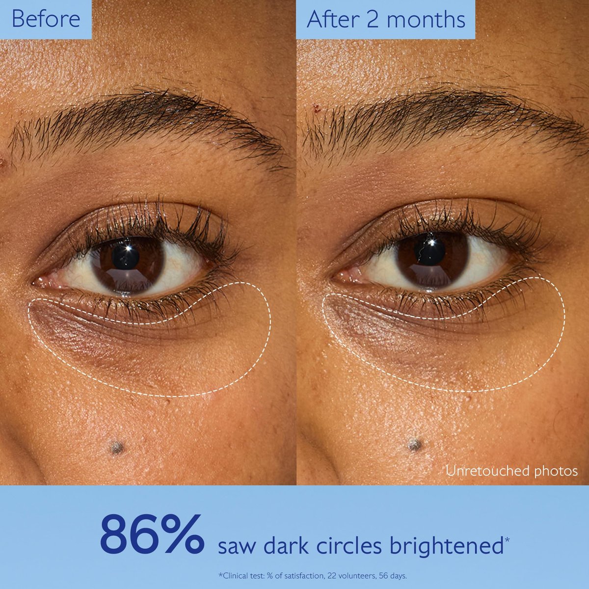 Caudalie Vinoperfect Dark Circle Brightening Caffeine Eye Cream with Niacinamide, Fragrance Free - 15 mL Avelisse