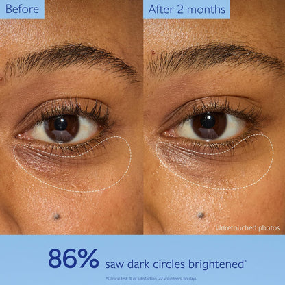 Caudalie Vinoperfect Dark Circle Brightening Caffeine Eye Cream with Niacinamide, Fragrance Free - 15 mL Avelisse