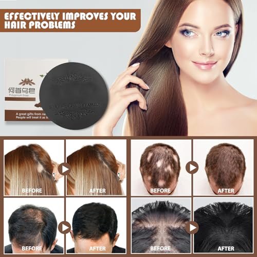 Fallopia Multiflora Shampoo Bar 3-Pack for Black & Thick Hair - He Shou Wu Shampoo Soap, Deeply Cleanses Scalp & Hair, Promotes Growth, Prevents Hair Loss - görsel 12