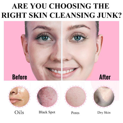 Aaenouicfs Clay Mask Set 20 Pods – Green Tea, Turmeric, Dead Sea Mud, Rose, 24K Gold, Eggplant, Avocado – Deep Cleansing Face Mask for Blackhead Removal, Men & Women