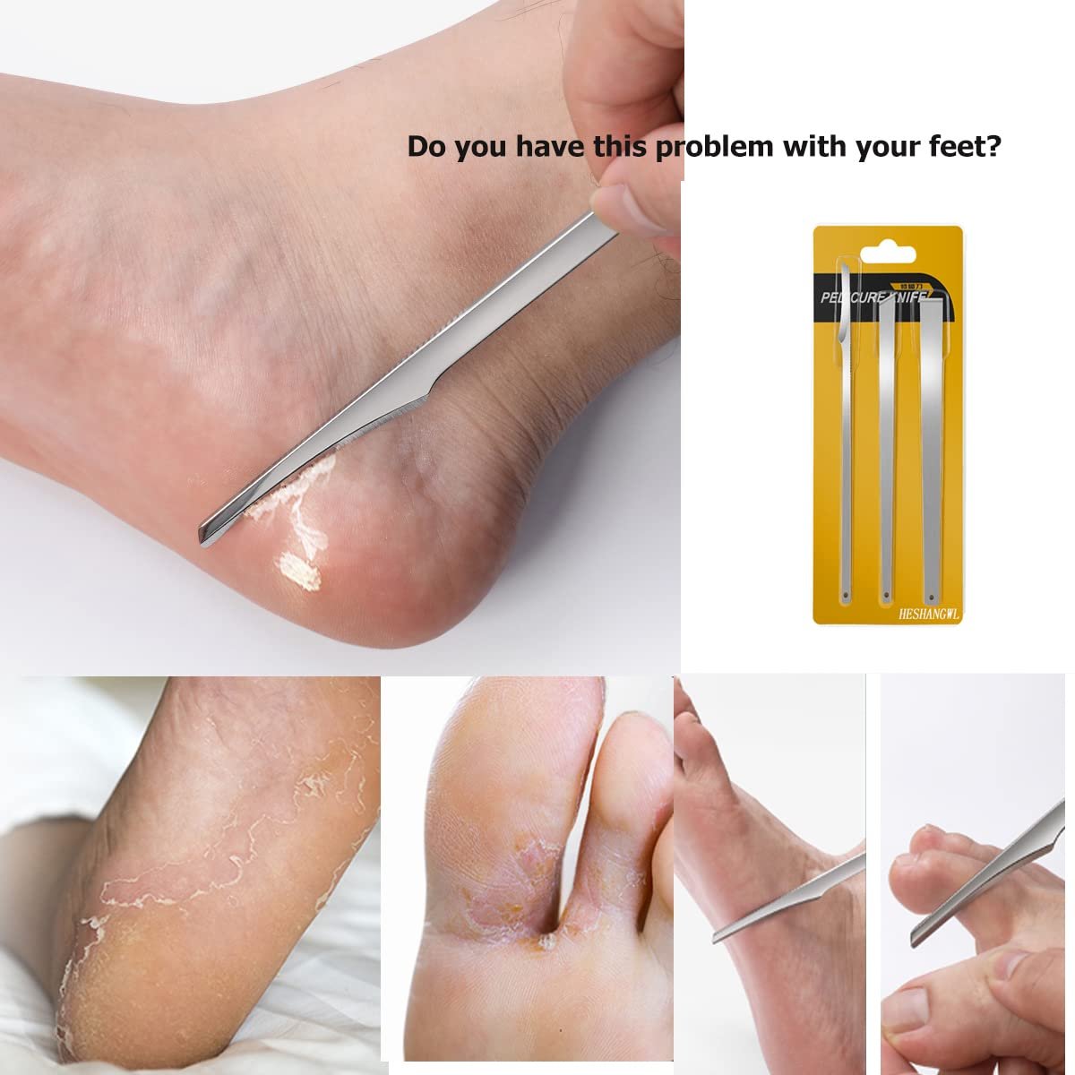 3-Piece Stainless Steel Ingrown Toenail Pedicure Knife Set - Professional Foot Skin Scraper & Callus Repair Blade Kit for Nail Corn Paronychia Treatment Avelisse