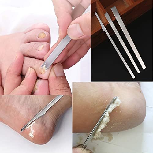 3-Piece Stainless Steel Ingrown Toenail Pedicure Knife Set - Professional Foot Skin Scraper & Callus Repair Blade Kit for Nail Corn Paronychia Treatment Avelisse