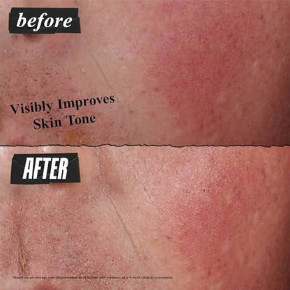 Kiehl's Ultra Facial Advanced Repair Barrier Cream - Intensive Moisturizer for Dry & Sensitive Skin, 1.7 oz Avelisse