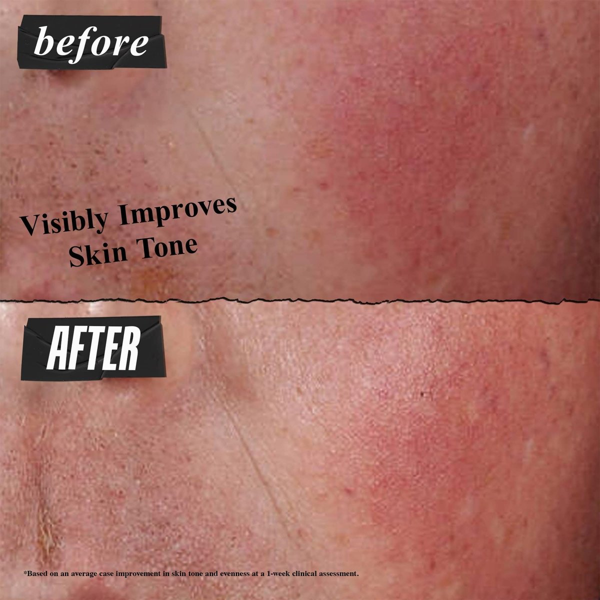 Kiehl's Ultra Facial Advanced Repair Barrier Cream - Intensive Moisturizer for Dry & Sensitive Skin, 1.7 oz Avelisse