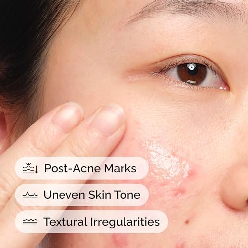 The Ordinary Aloe 2% + NAG 2% Solution – Soothing Serum for Post-Acne Marks, 1 fl oz Avelisse