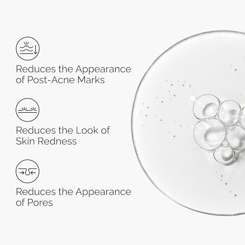 The Ordinary Aloe 2% + NAG 2% Solution – Soothing Serum for Post-Acne Marks, 1 fl oz Avelisse
