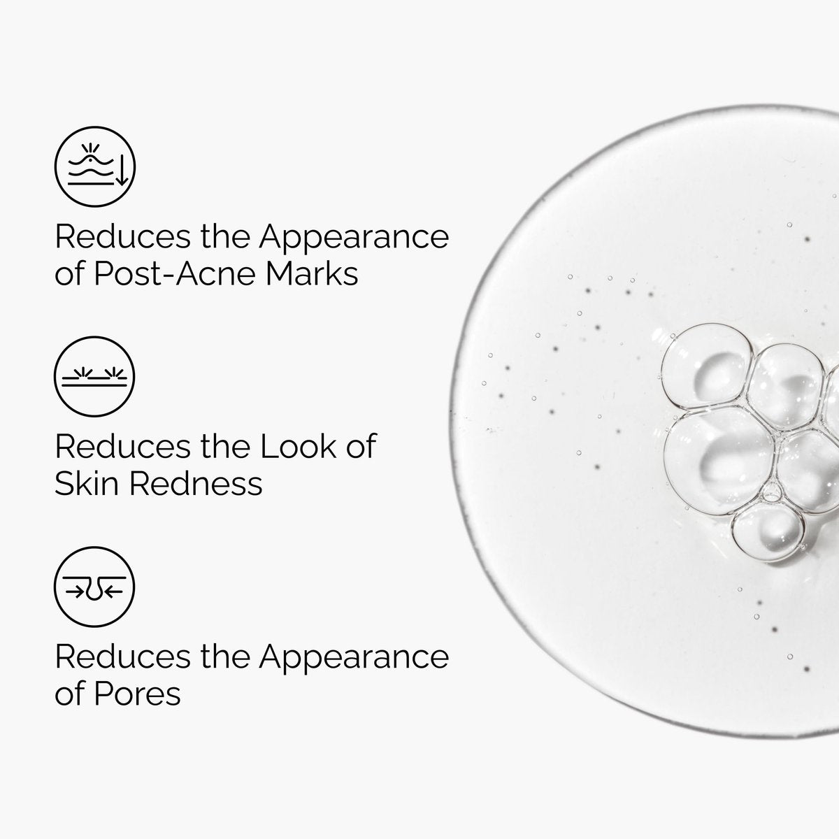 The Ordinary Aloe 2% + NAG 2% Solution – Soothing Serum for Post-Acne Marks, 1 fl oz Avelisse