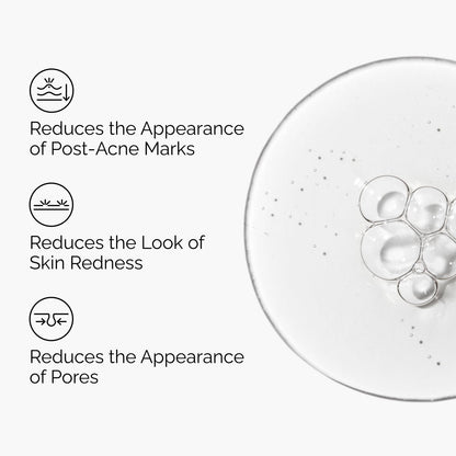 The Ordinary Aloe 2% + NAG 2% Solution – Soothing Serum for Post-Acne Marks, 1 fl oz Avelisse