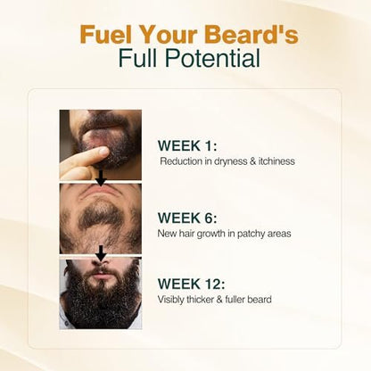 NOURISH MANTRA Advanced Beard Growth Oil Serum with Redensyl, Capilia Longa, Argan Oil, Vitamin E & Jojoba Oil for Fuller, Thicker & Healthier Beard | 30 ml Avelisse