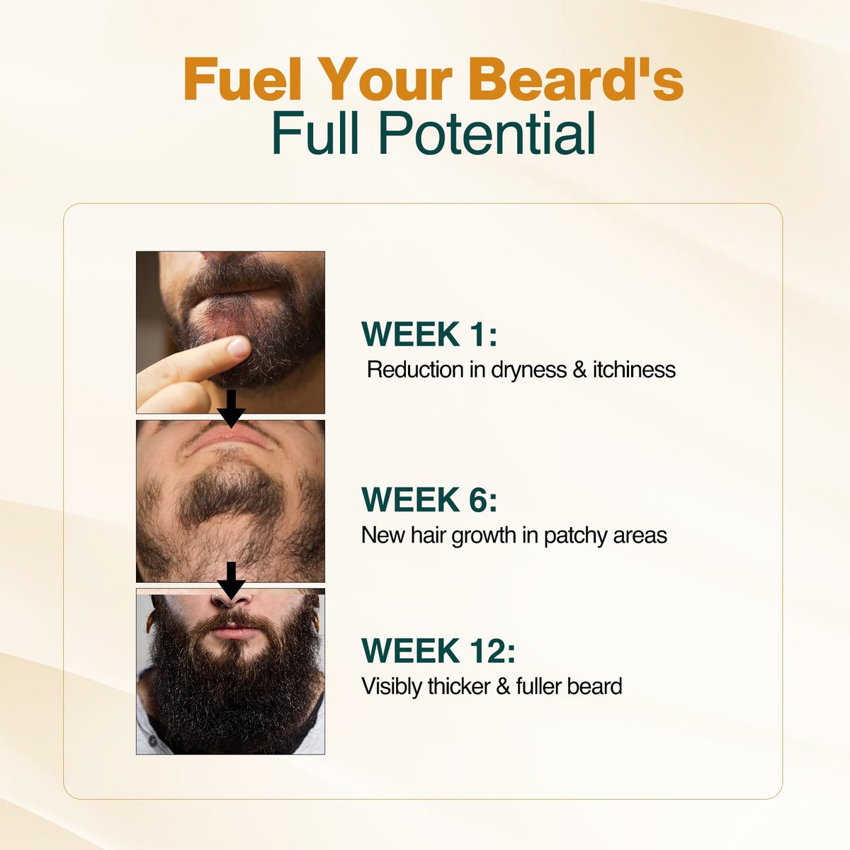 NOURISH MANTRA Advanced Beard Growth Oil Serum with Redensyl, Capilia Longa, Argan Oil, Vitamin E & Jojoba Oil for Fuller, Thicker & Healthier Beard | 30 ml Avelisse