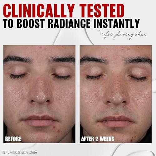 Thayers 2% AHA Exfoliating and Brightening Toner with Glycolic Acid, Lactic Acid and Witch Hazel - Smoothing and Pore Refining Skin Care for All Skin Types, 12 Fl Oz - görsel 6