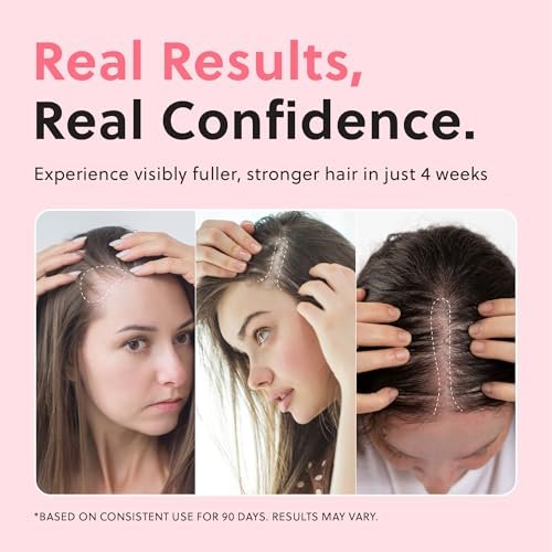 ForChics Hair Growth Serum for Women – Results in 4 Weeks – Hormone-Free Hair Regrowth Treatment for Thinning Hair Loss – Fast Absorbing Non-Greasy Scalp Spray 50ml - görsel 6