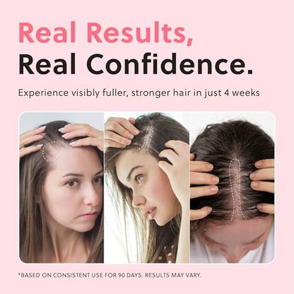 ForChics Hair Growth Serum for Women – Results in 4 Weeks – Hormone-Free Hair Regrowth Treatment for Thinning Hair Loss – Fast Absorbing Non-Greasy Scalp Spray 50ml
