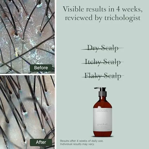 GOOD&ALL Tea Tree Shampoo for Dry Itchy Scalp with Peppermint - Sulfate-Free, Silicone-Free, Paraben-Free, Fragrance-Free - 13.5 fl oz Avelisse