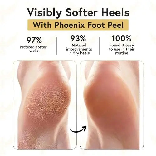 Phoenix Foot Peel Moisturizing Gel Socks for Men - Extra Large 2 Pairs - Silicone Heel Socks, Cracked Heel Treatment, Reusable Spa Socks with Shea Butter for Dry Skin & Foot Care Avelisse