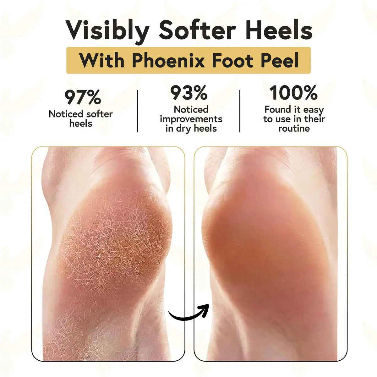 Phoenix Foot Peel Moisturizing Gel Socks for Men - Extra Large 2 Pairs - Silicone Heel Socks, Cracked Heel Treatment, Reusable Spa Socks with Shea Butter for Dry Skin & Foot Care Avelisse