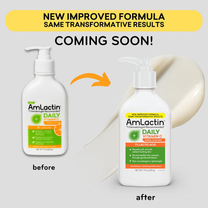 AmLactin Daily Vitamin C Lotion – Brightening Body Lotion for Dry Skin, No-Scrub Exfoliator with 7% Lactic Acid AHA and Vitamin C, 7.9 oz