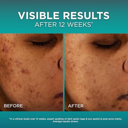 L'Oréal Paris Bright Reveal 12% Niacinamide + Amino Sulfonic + Ferulic Dark Spot Serum, 1 oz with Moisturizer Sample Avelisse