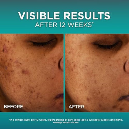 L'Oréal Paris Bright Reveal 12% Niacinamide + Amino Sulfonic + Ferulic Dark Spot Serum, 1 oz with Moisturizer Sample Avelisse