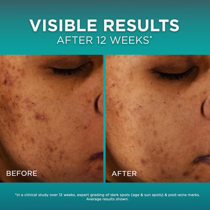 L'Oréal Paris Bright Reveal 12% Niacinamide + Amino Sulfonic + Ferulic Dark Spot Serum, 1 oz with Moisturizer Sample Avelisse