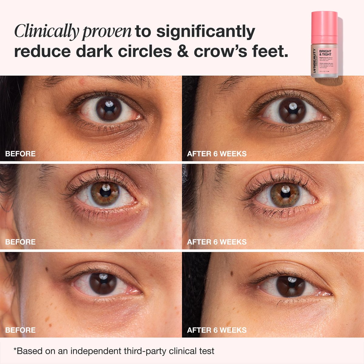 Innbeauty Project Bright & Tight Eye Cream with Vitamin C & Peptides for Dark Circles & Firming, 0.5 oz Avelisse