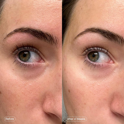 Topicals Faded Brightening Under Eye Masks – Depuff, Hydrate & Brighten with Kojic Acid, Caffeine & Niacinamide (6 Patches) Avelisse