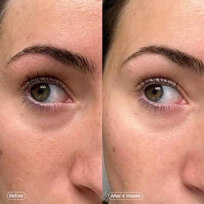 Topicals Faded Brightening Under Eye Masks – Depuff, Hydrate & Brighten with Kojic Acid, Caffeine & Niacinamide (6 Patches) Avelisse