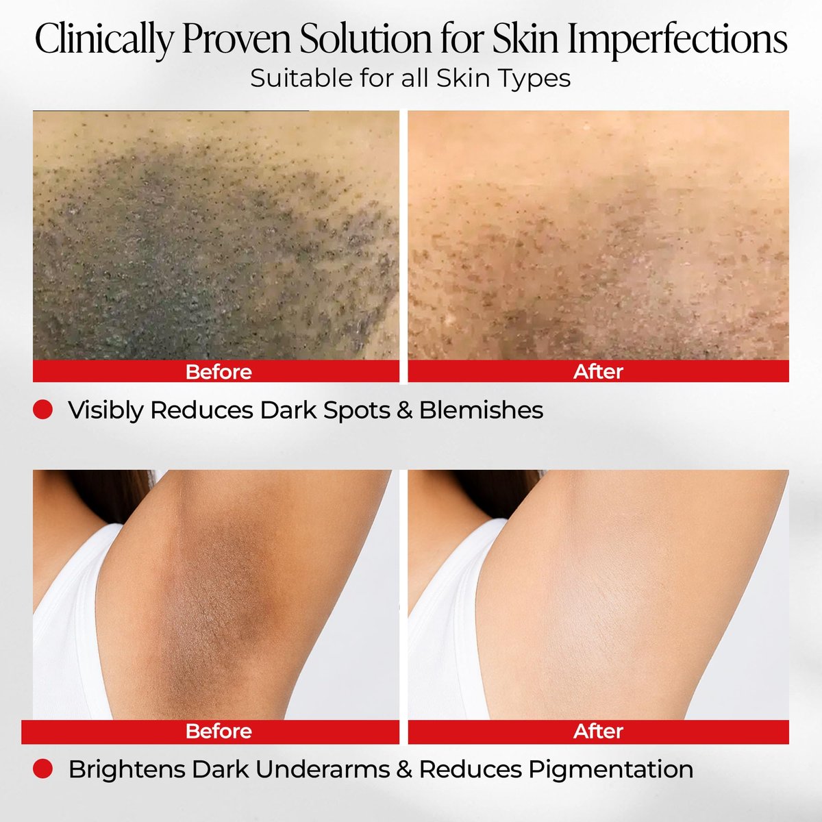 Dark Spot Correcting Cream for Intimate Areas – Intimate Lightening & Brightening Cream for Women Bikini Line Inner Thigh & Underarm Whitening with Tranexamic Acid & Niacinamide, Sensitive Skin Safe, 1 oz Avelisse