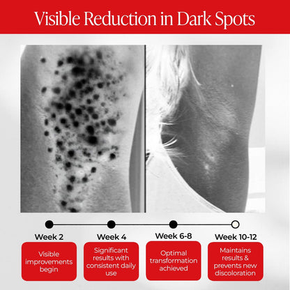Dark Spot Correcting Cream for Intimate Areas – Intimate Lightening & Brightening Cream for Women Bikini Line Inner Thigh & Underarm Whitening with Tranexamic Acid & Niacinamide, Sensitive Skin Safe, 1 oz Avelisse